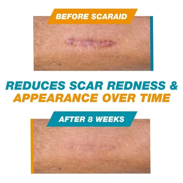 Thumbnail 12